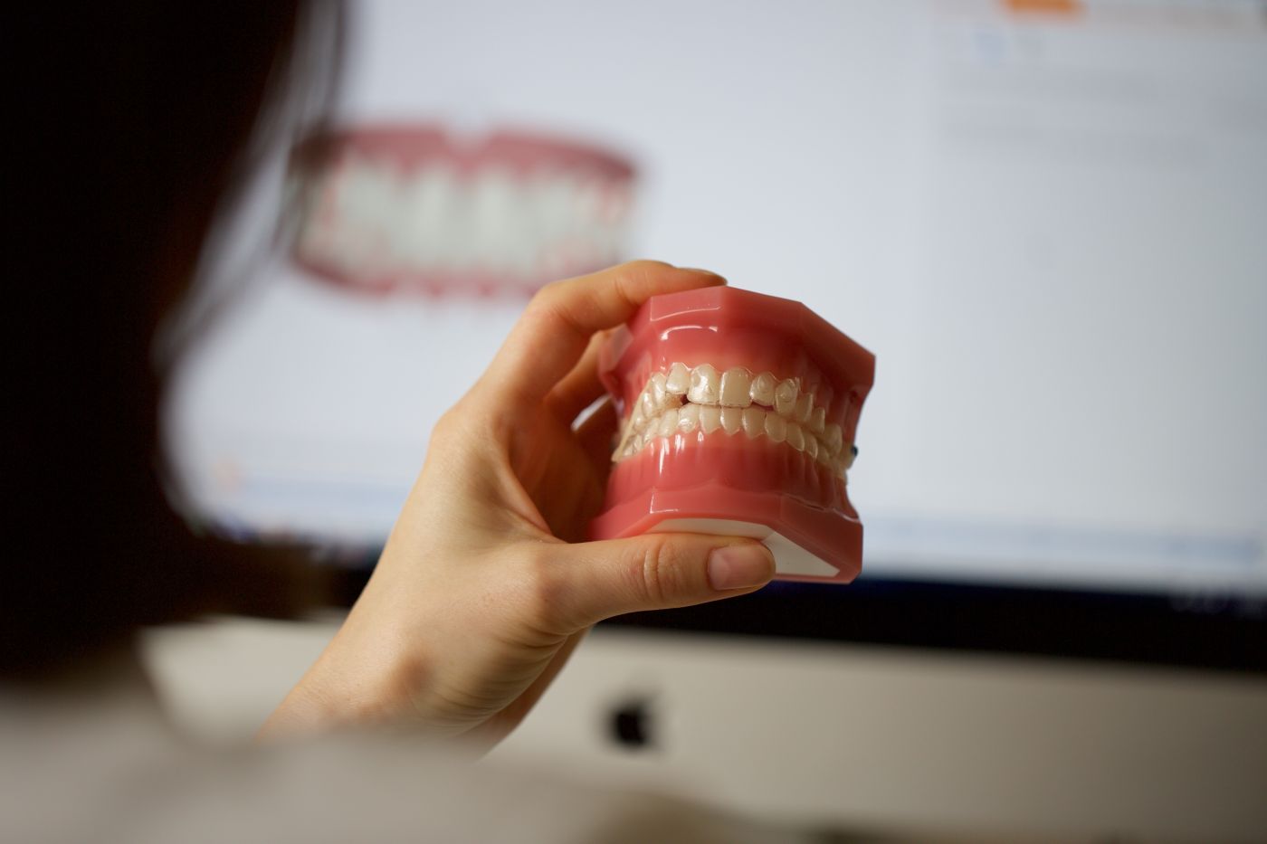 Zahnspangenmodell für Kinder und Erwachsene bei Kieferorthopäde KFO am Grindel